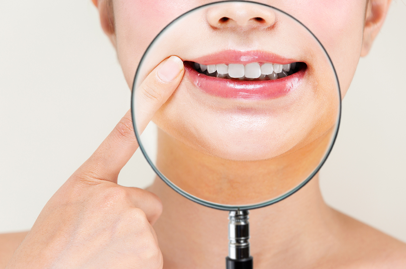 ホワイトニング